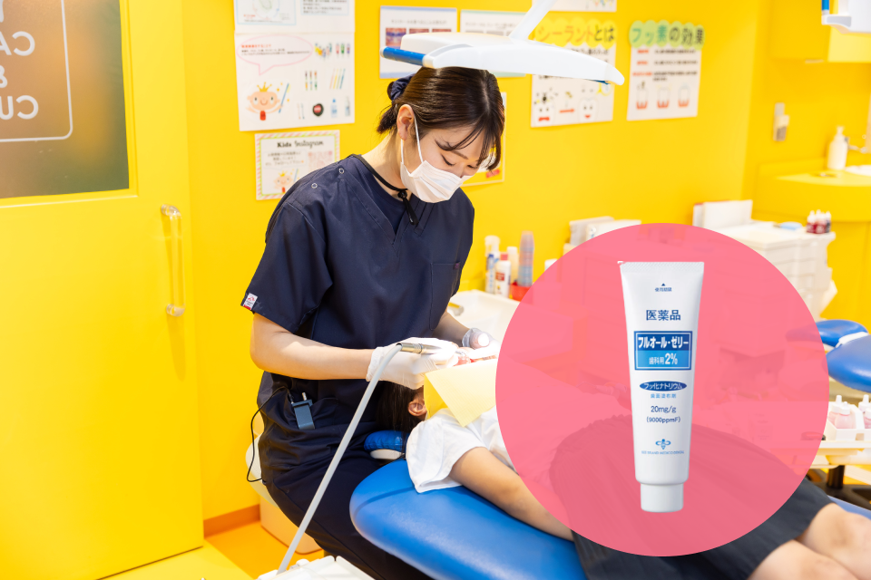 フッ素塗布