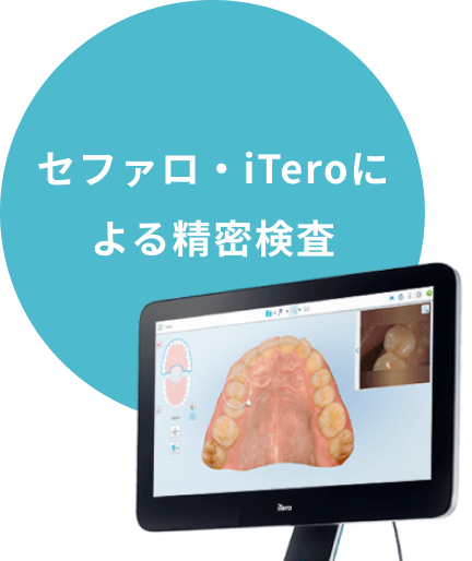 セファロ・iTeroによる精密検査