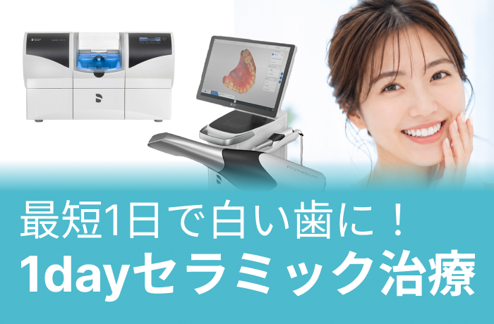セレックシステム