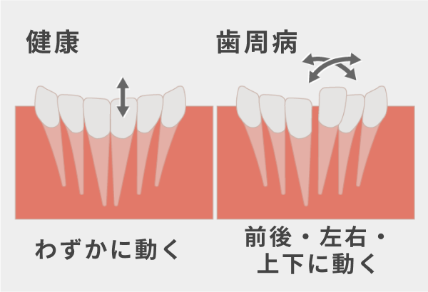 動揺度検査