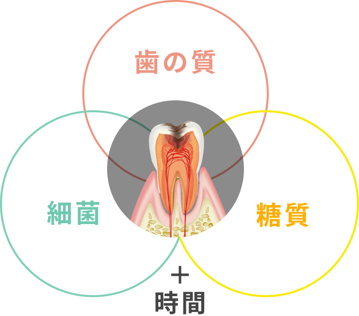 虫歯ができる理由