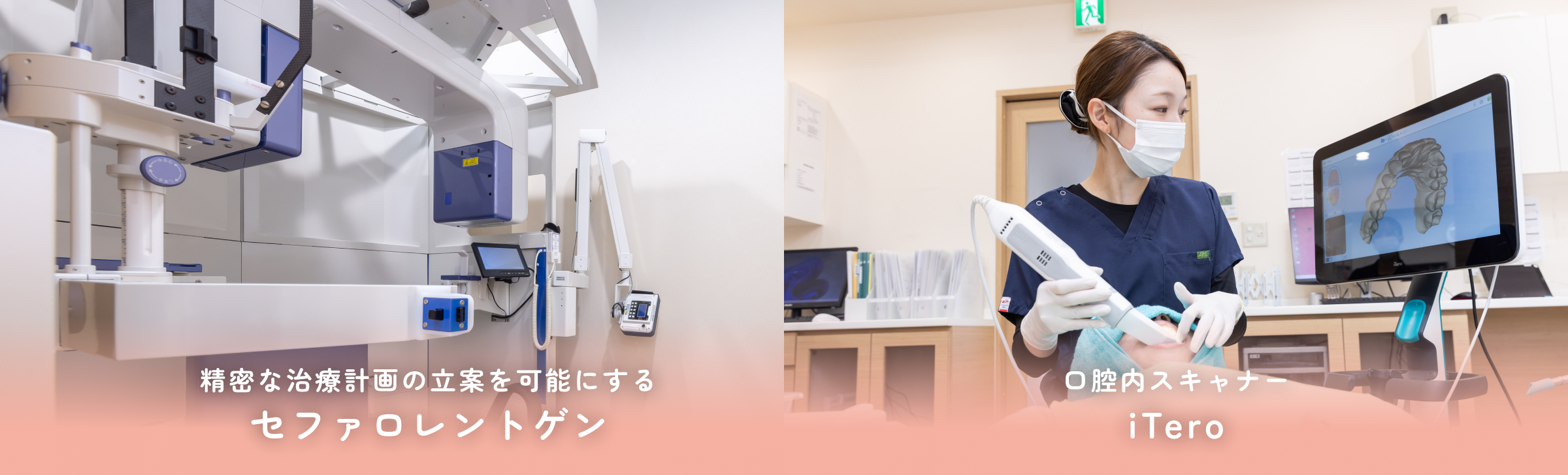 セファロレントゲン、iTeroによる精密検査・診断