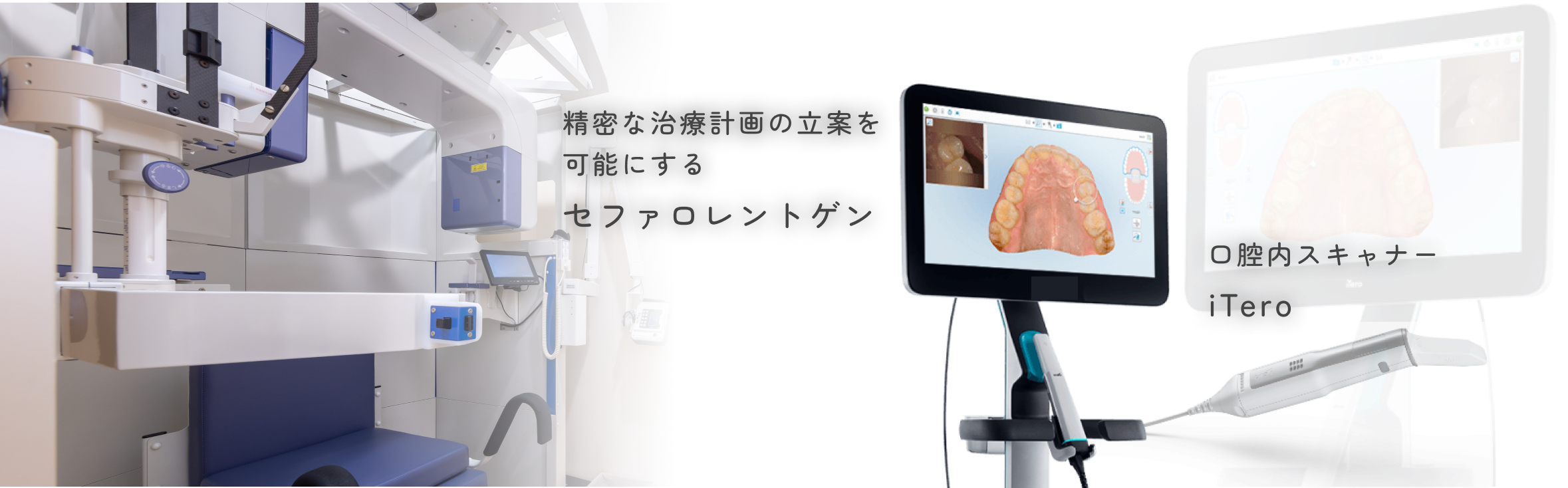 セファロレントゲン、iTeroによる精密検査・診断
